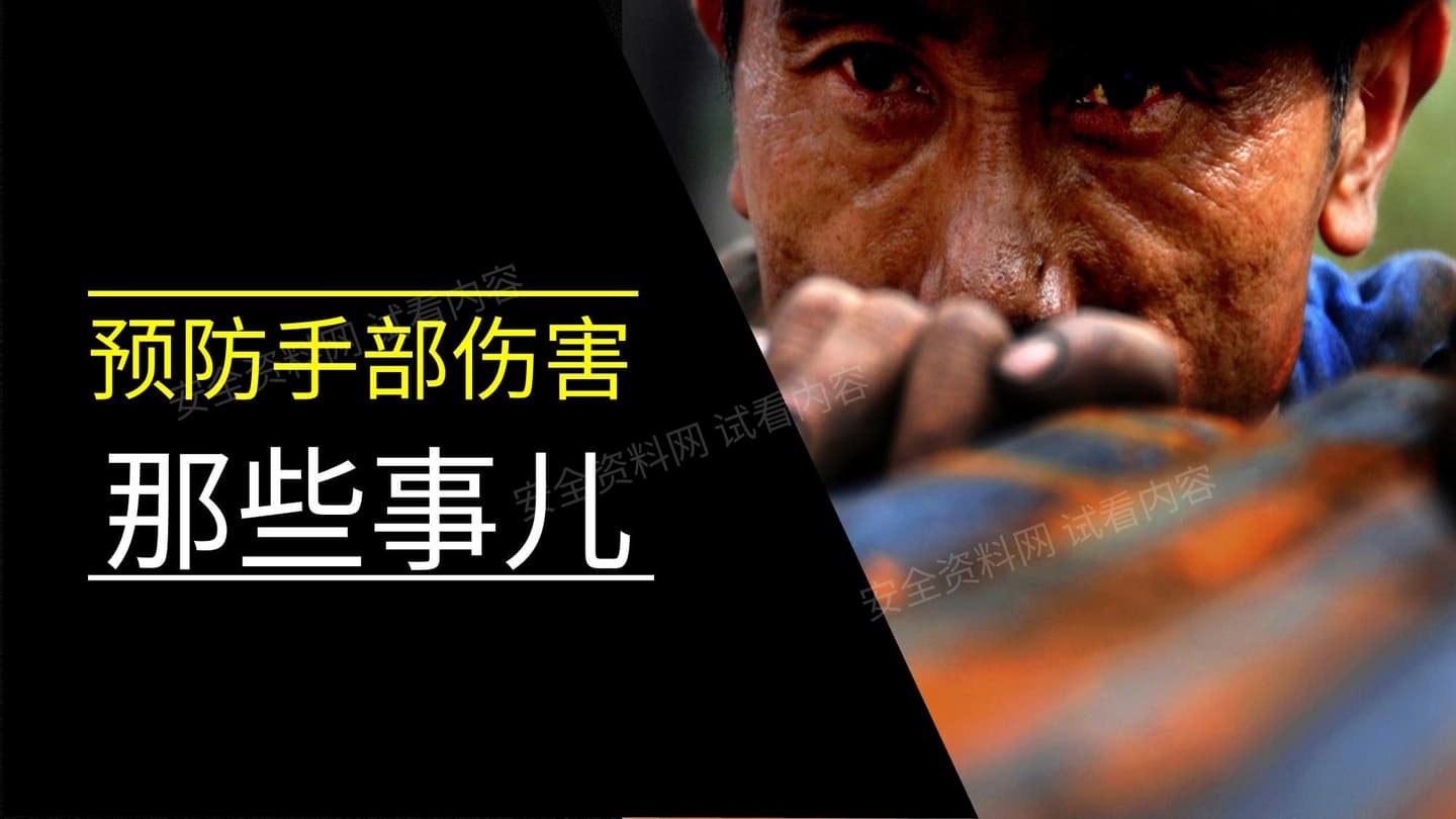 手部事故预防那些事儿