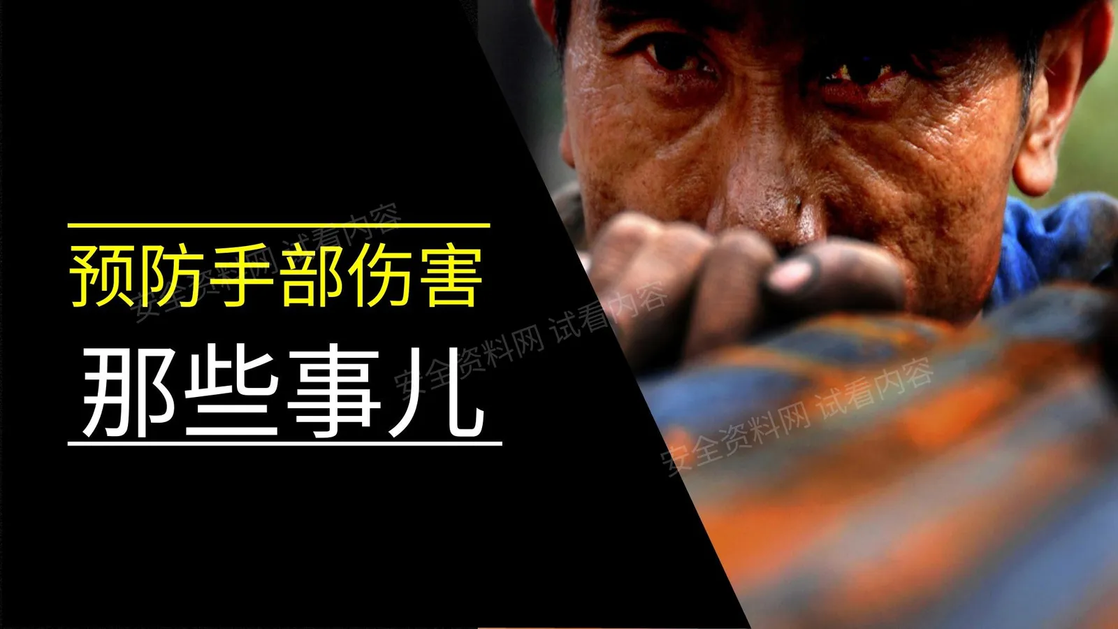 手部事故预防那些事儿 第 1 页预览